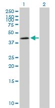 Anti-NDUFS2 Mouse Polyclonal Antibody