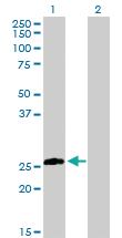 Anti-STX8 Rabbit Polyclonal Antibody