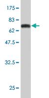 Anti-DCPS Mouse Monoclonal Antibody [clone: 3E5]