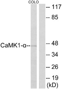 Western blot analysis of lysates from COLO cells using Anti-CaMK1-alpha Antibody The right hand lane represents a negative control, where the antibody is blocked by the immunising peptide