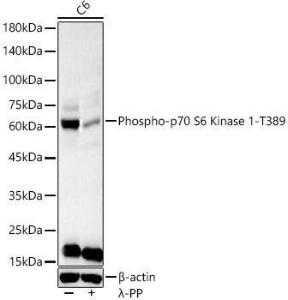 Anti-S6K1