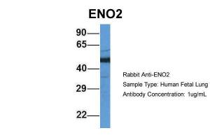 Anti-ENO2 Rabbit Polyclonal Antibody