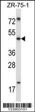 Anti-MDM4 Rabbit Polyclonal Antibody (HRP (Horseradish Peroxidase))