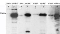 Anti-AIRE Antibody (A84291) staining (0.05µg/ml) of HEK293 cell lysates. Untransfected (Lane 5 and 7) and transfected with Human AIRE (lane 6) or Mouse AIRE (lane 7).