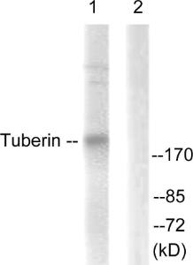 Western blot analysis of lysates from 293 cells, treated with Anisomycin 25ug/ml 30' using Anti-Tuberin Antibody. The right hand lane represents a negative control, where the antibody is blocked by the immunising peptide