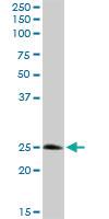 Anti-STX8 Rabbit Polyclonal Antibody