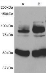 Anti-APPL1 Antibody (A84292) (05 µg/ml) staining of 1) Rat Aortic Smooth Muscle cell lysate 2) after infection with Human APPL1 adenovirus for 48hrs Detected by chemiluminescence