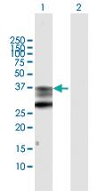 Anti-PTGES2 Rabbit Polyclonal Antibody