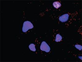 Anti-PTK2 + TP53 Antibody Pair