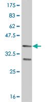 Anti-FOXO1 Mouse Monoclonal Antibody [clone: 4A3]