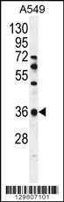 Anti-OR2M7 Rabbit Polyclonal Antibody (FITC (Fluorescein Isothiocyanate))