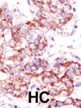 Anti-USP4 Rabbit Polyclonal Antibody