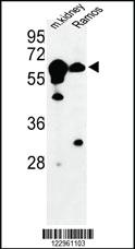 Anti-CBS Rabbit Polyclonal Antibody