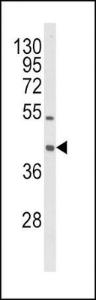 Anti-LOX1 Rabbit Polyclonal Antibody (FITC (Fluorescein))