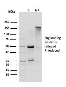 SDS-PAGE analysis of Anti-delta 1 Catenin Antibody [CTNND1/4383R] under non-reduced and reduced conditions; showing intact IgG and intact heavy and light chains, respectively. SDS-PAGE analysis confirms the integrity and purity of the Antibody