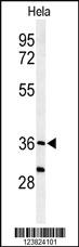 Anti-SUMF1 Rabbit Polyclonal Antibody