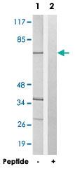 Anti-ND5 Rabbit Polyclonal Antibody