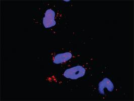 Anti-MAPK8 + RHOA Antibody Pair