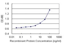 Anti-FEZ1 Polyclonal Antibody Pair