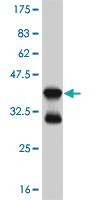 Anti-FOXO1 Mouse Monoclonal Antibody [clone: 3A10]