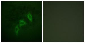 Immunofluorescence analysis of HepG2 cells using Anti-Tuberin Antibody. The right hand panel represents a negative control, where the antibody was pre-incubated with the immunising peptide