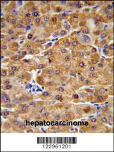 Anti-CBS Rabbit Polyclonal Antibody