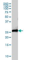 Anti-STX8 Mouse Monoclonal Antibody [clone: 2H1-1D11]