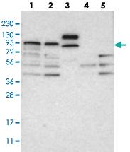 Anti-ABCG8 Rabbit Polyclonal Antibody