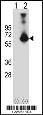 Anti-CBS Rabbit Polyclonal Antibody