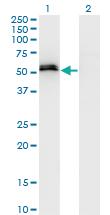 Anti-SPP1 Mouse Monoclonal Antibody [clone: 3C7]