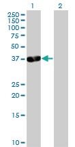 Anti-PDLIM3 Mouse Polyclonal Antibody