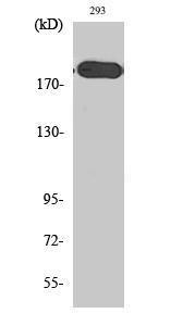 Western blot analysis of various cells using Anti-Tuberin Antibody