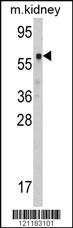 Anti-CBS Rabbit Polyclonal Antibody