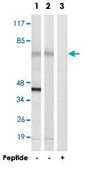 Anti-ME3 Rabbit Polyclonal Antibody