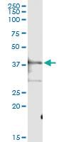 Anti-PTGES2 Rabbit Polyclonal Antibody