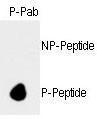 Anti-RB1 Rabbit Polyclonal Antibody (APC (Allophycocyanin))