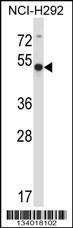 Anti-ACTR6 Rabbit Polyclonal Antibody (APC (Allophycocyanin))