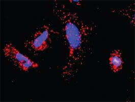 Anti-TRAF2 + TRAF1 Antibody Pair