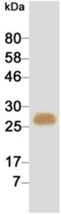 Western blotting result