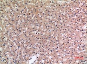 Immunohistochemical analysis of paraffin-embedded human liver using Anti-SLC10A1 Antibody