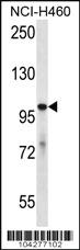 Anti-USP6 Rabbit Polyclonal Antibody