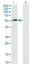 Anti-SPP1 Mouse Monoclonal Antibody [clone: 1D7]