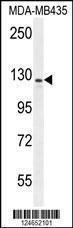 Anti-IBTK Rabbit Polyclonal Antibody (APC (Allophycocyanin))