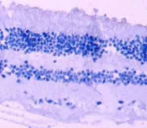 Anti-ARR3 antibody