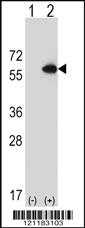 Anti-CBS Rabbit Polyclonal Antibody