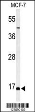 Anti-BOD1 Rabbit Polyclonal Antibody