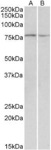 Anti-DAG1 Antibody (A82725) (0.1 µg/ml) staining of Mouse and Rat Skeletal Muscle lysate (35 µg protein in RIPA buffer). Primary incubation was 1 hour. Detected by chemiluminescence