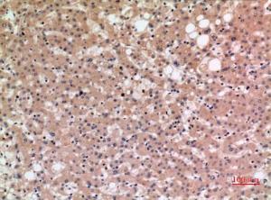 Immunohistochemical analysis of paraffin-embedded human liver using Anti-SLC10A1 Antibody