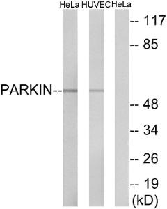 Western blot analysis of lysates from HeLa and HUVEC cells using Anti-Parkin Antibody. The right hand lane represents a negative control, where the antibody is blocked by the immunising peptide.