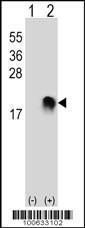 Anti-SUMO2, SUMO3 Rabbit Polyclonal Antibody